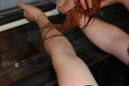 DSC_3631 Here is one of Stingmate's test subjects with a live jellyfish's tentacles laid across his arms.