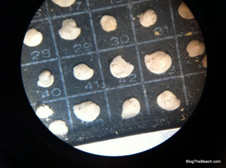 foraminifera viewed under the microscope